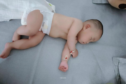 广饶六个月宝宝眼睛散光